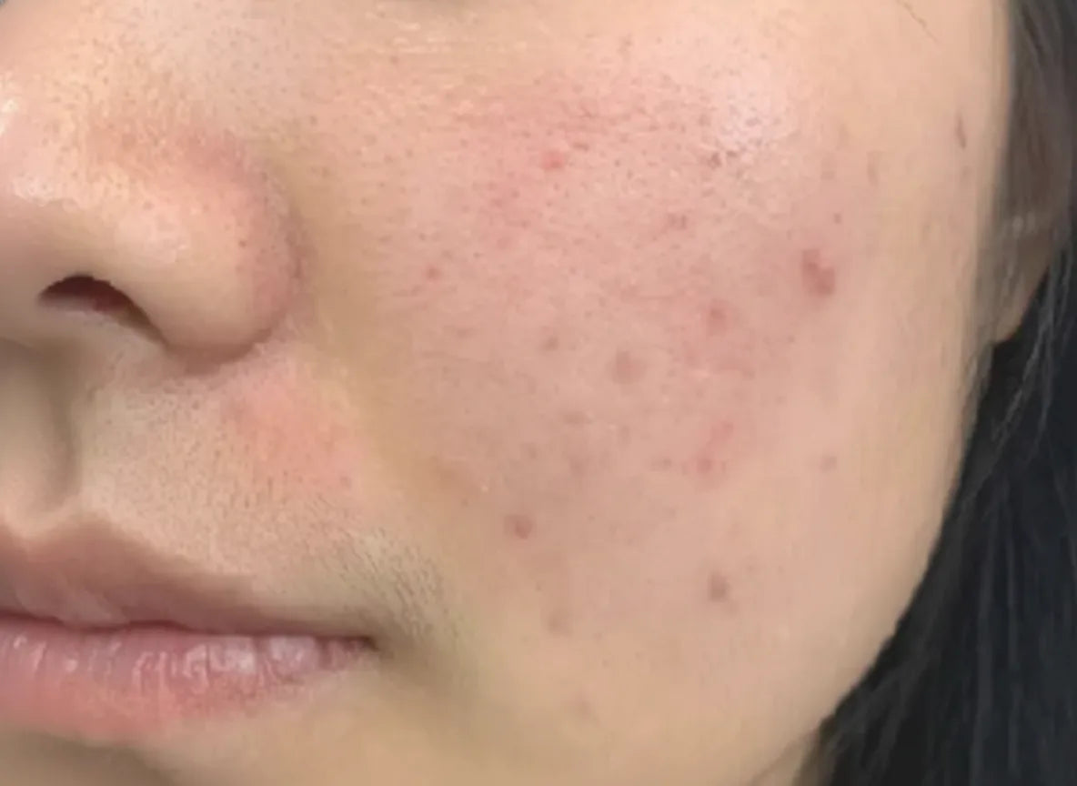 "My skin feels renewed — softer, clearer, and more balanced."