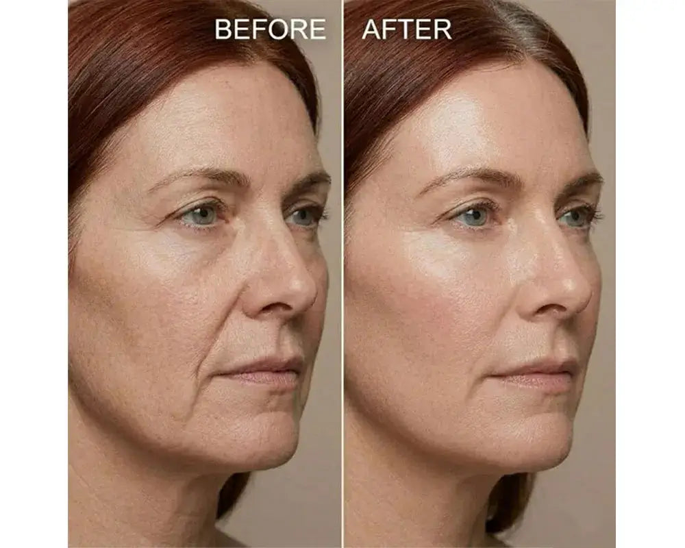 Before and After comparison