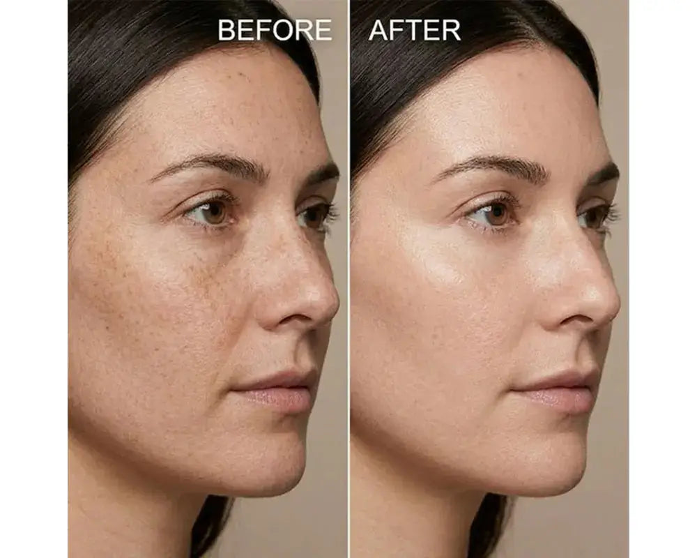 Before and After comparison