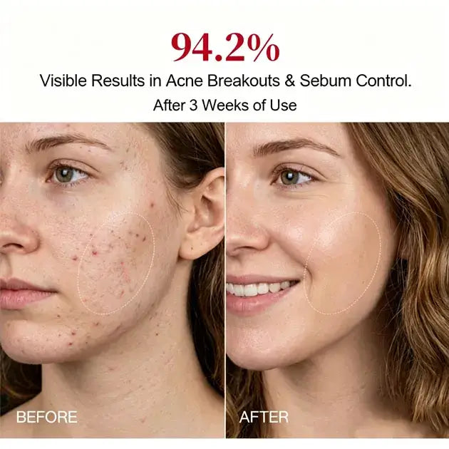 Red Light Therapy Mask for Face