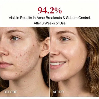 Red Light Therapy Mask for Face