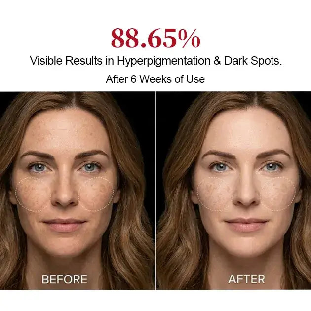 Red Light Therapy Mask for Face