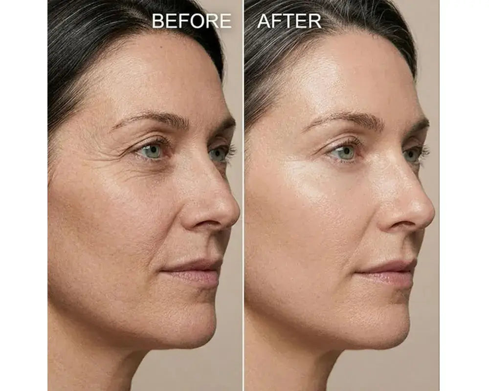 Before and After comparison